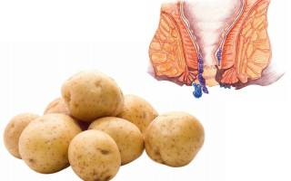 Лечение геморроя в домашних условиях картофелем
